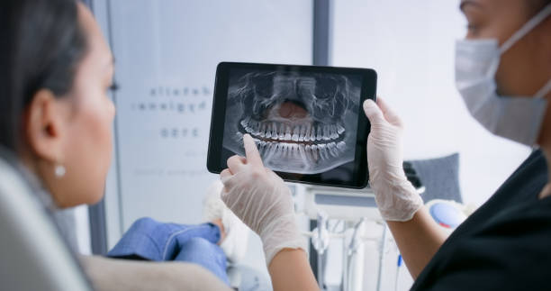 Licensed Teeth Whitening service in Haskell, TX - Smile Center Dentistry