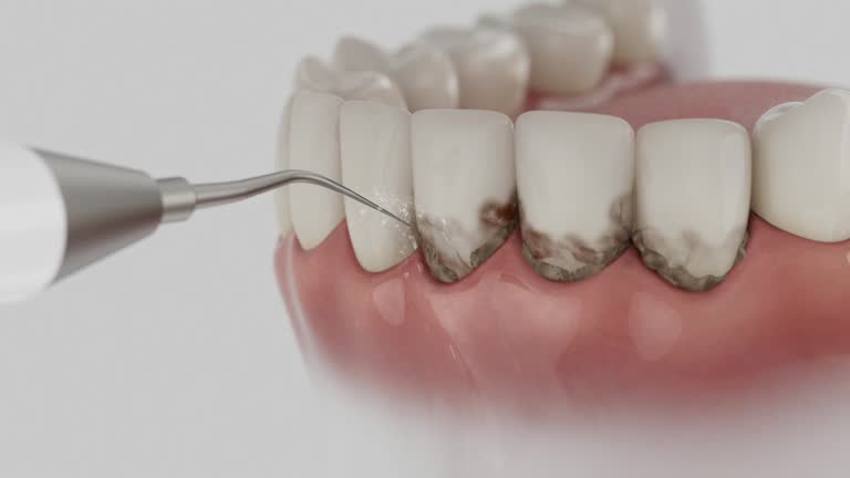 Reliable Teeth Whitening contractor in Haskell, TX by Smile Center Dentistry